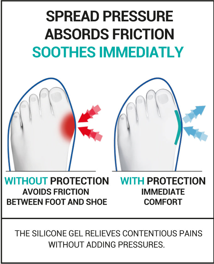 Epitact - Bunion Protector - Daily Protection