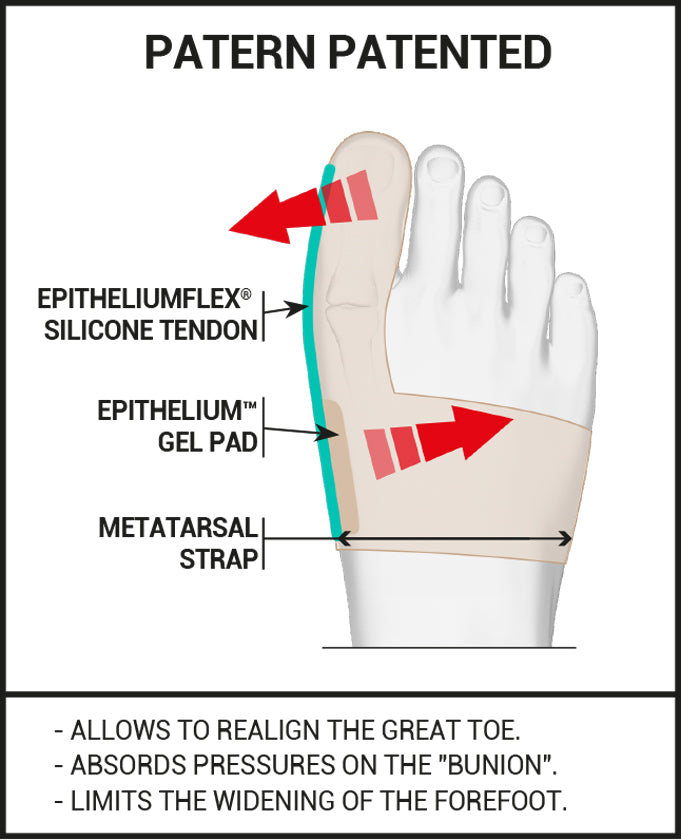 Epitact - Bunion Brace - Day - Hallux Valgus Corrective Brace
