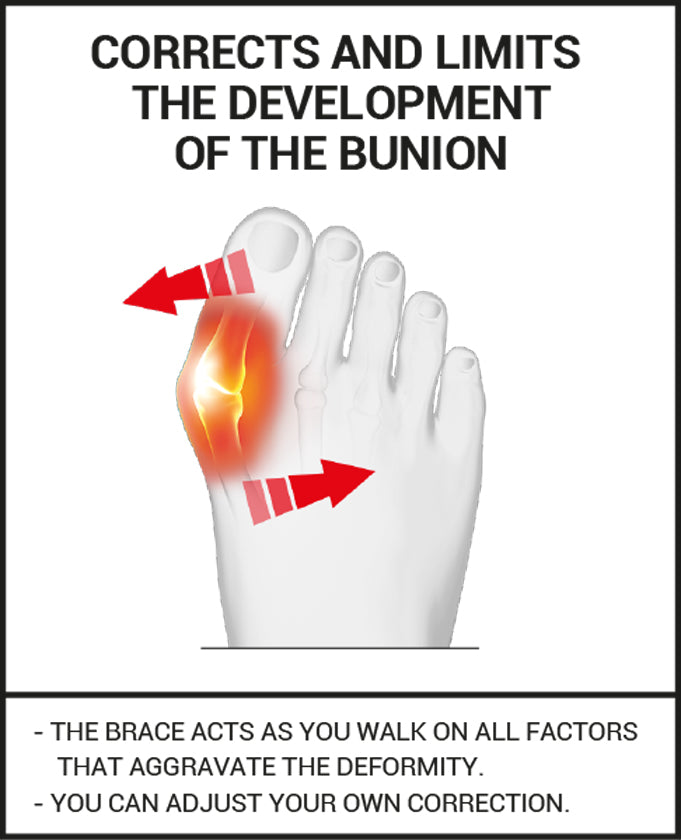 Epitact - Bunion Brace - Day - Hallux Valgus Corrective Brace