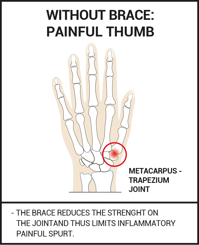 Epitact - Flexible Thumb Brace - Relieves Joint Pain (Right Hand)