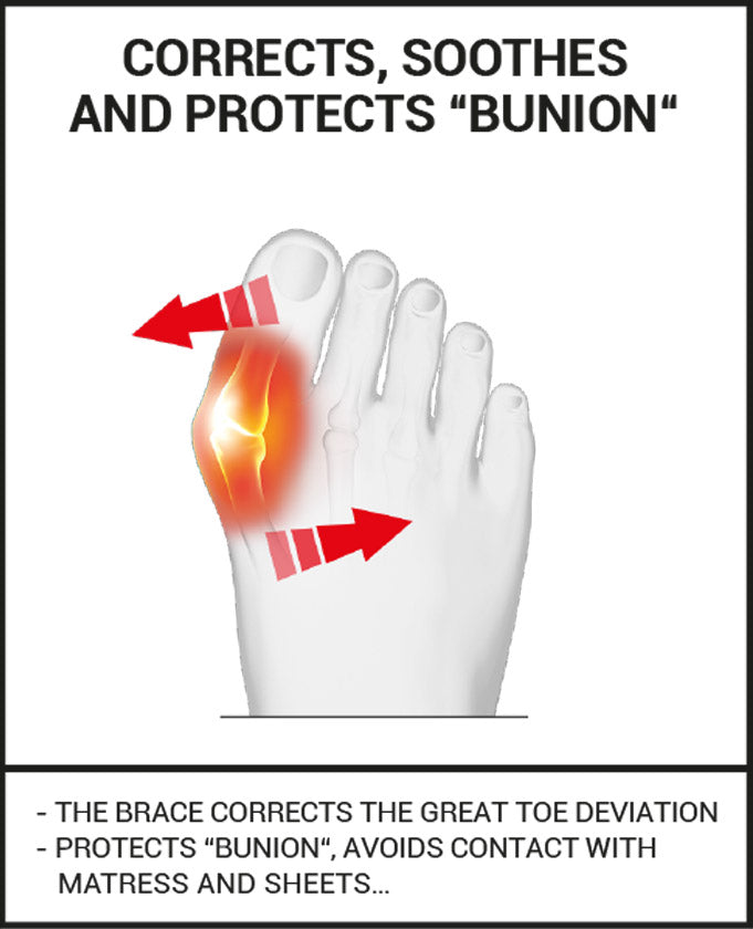 Epitact - Rigid Bunion Corrector - Night - Relieves Night-Time Pain