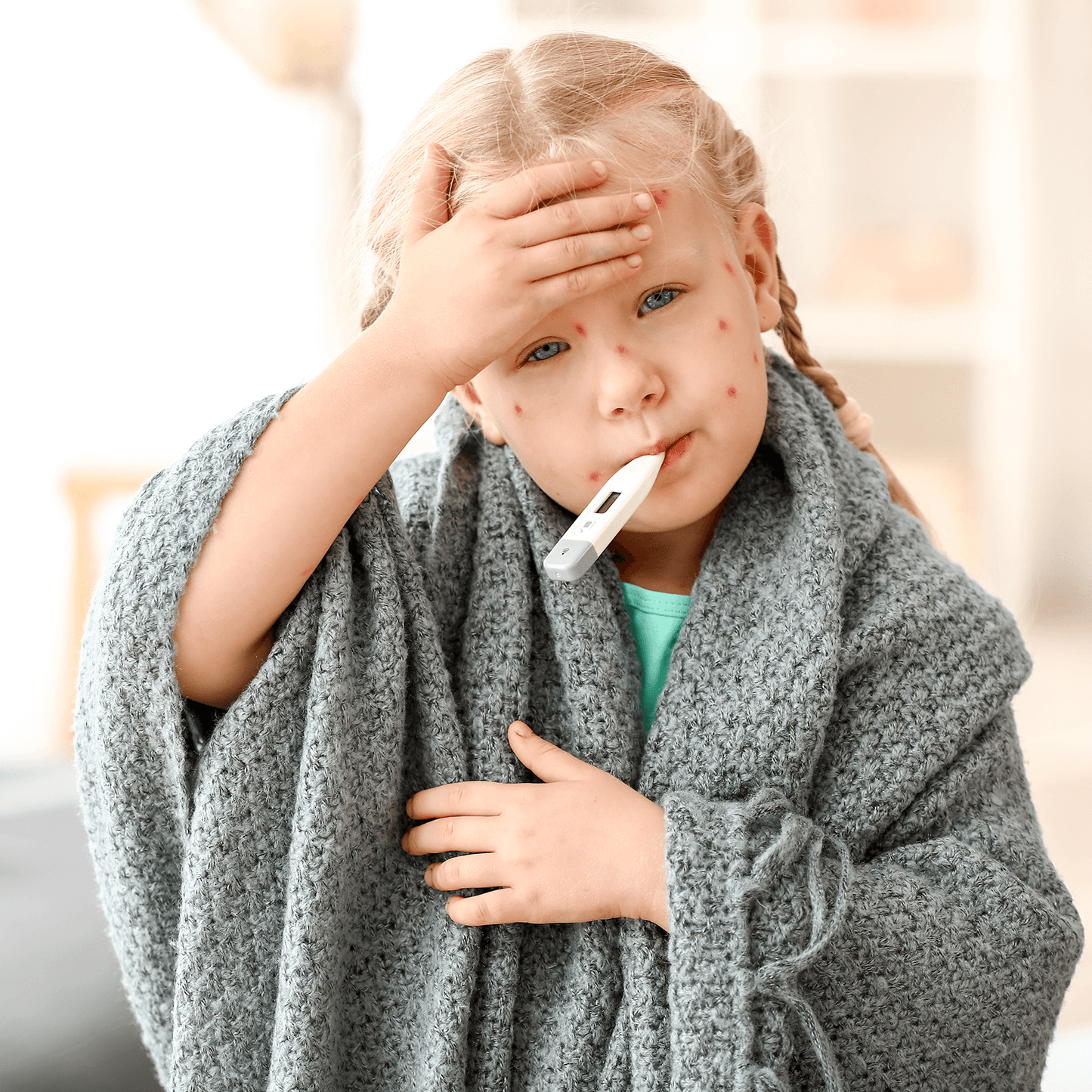 Kidsner - Coco - The Cooling Foam for Chickenpox
