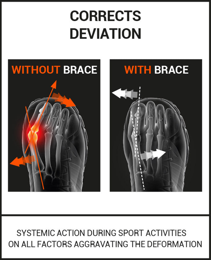 Epitact Sport Flexible Bunion Brace